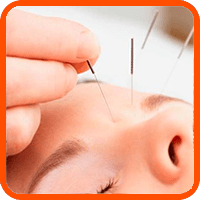 marco acupuntura-2